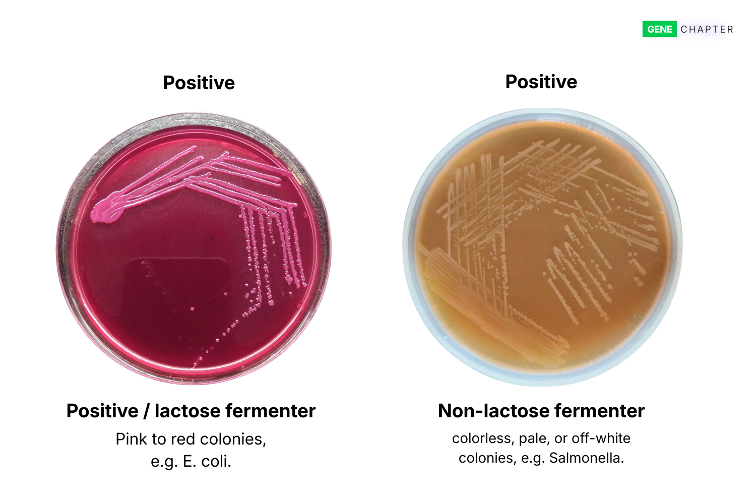 MacConkey Agar: Composition, Principle, Preparation, Interpretation, Uses